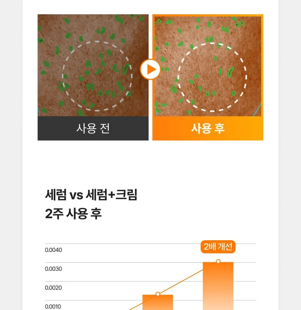 [흔적,기미,미백/TXA] 셀리맥스 트라넥삼산 잡티 크림 35ml 상세페이지 40